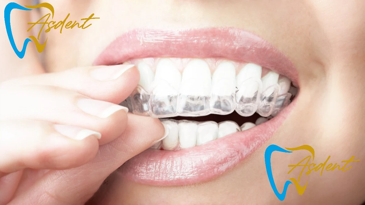 Temporomandibular Eklem Bozukluğu Tedavisi