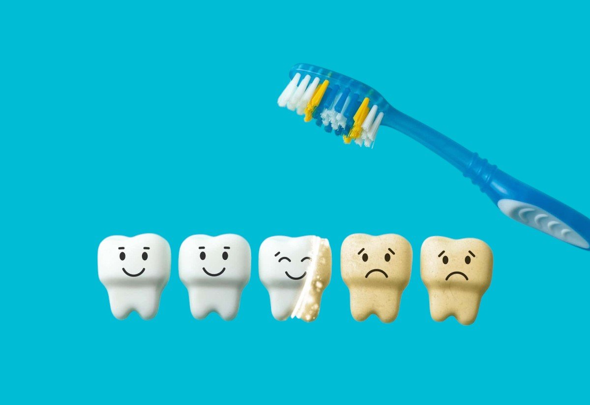 Teeth Whitening in Turkey