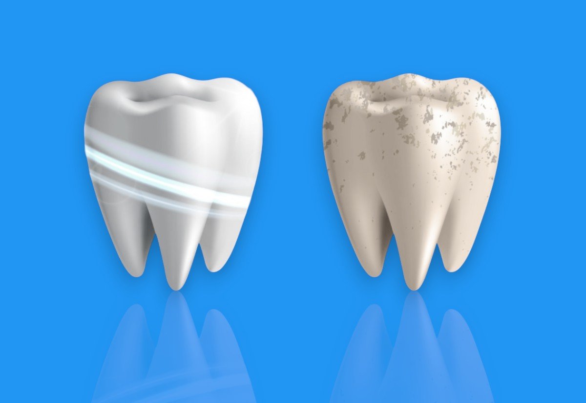 ASDENT Dental Turkey Teeth Whitening Products